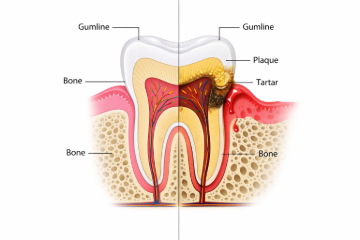 Gum Anatomy Diagram