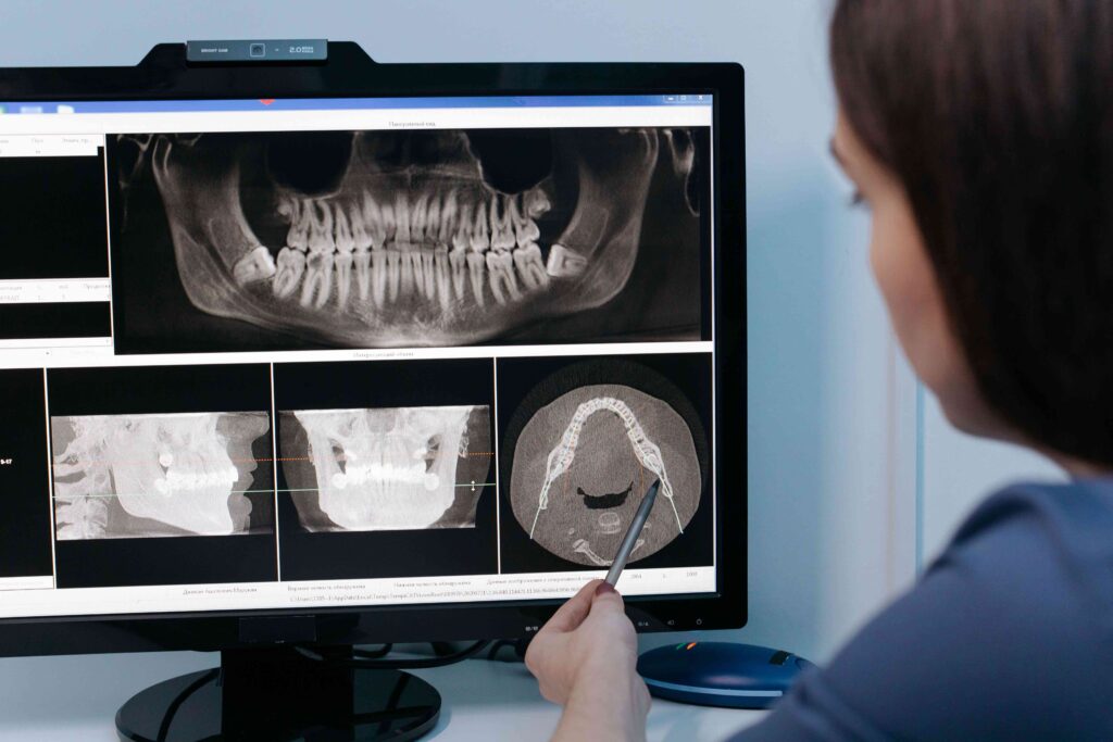 Dentist reviewing CBCT 3D jaw scan on large monitor