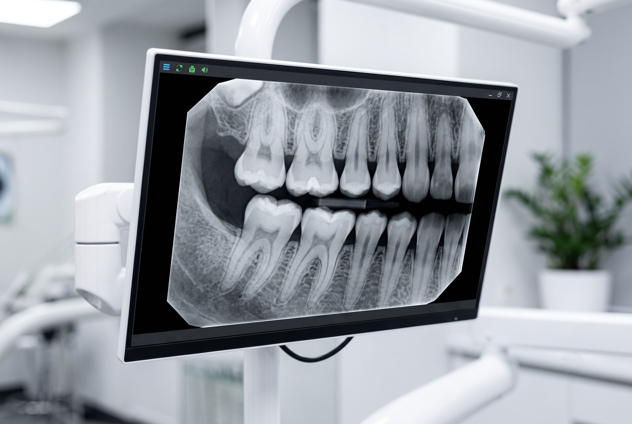 Digital X-Ray Sensor Monitor Display